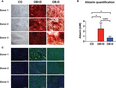 Secretomes derived from osteogenically differentiated jaw periosteal cells inhibit phenotypic and functional maturation of CD14+ monocyte-derived dendritic cells